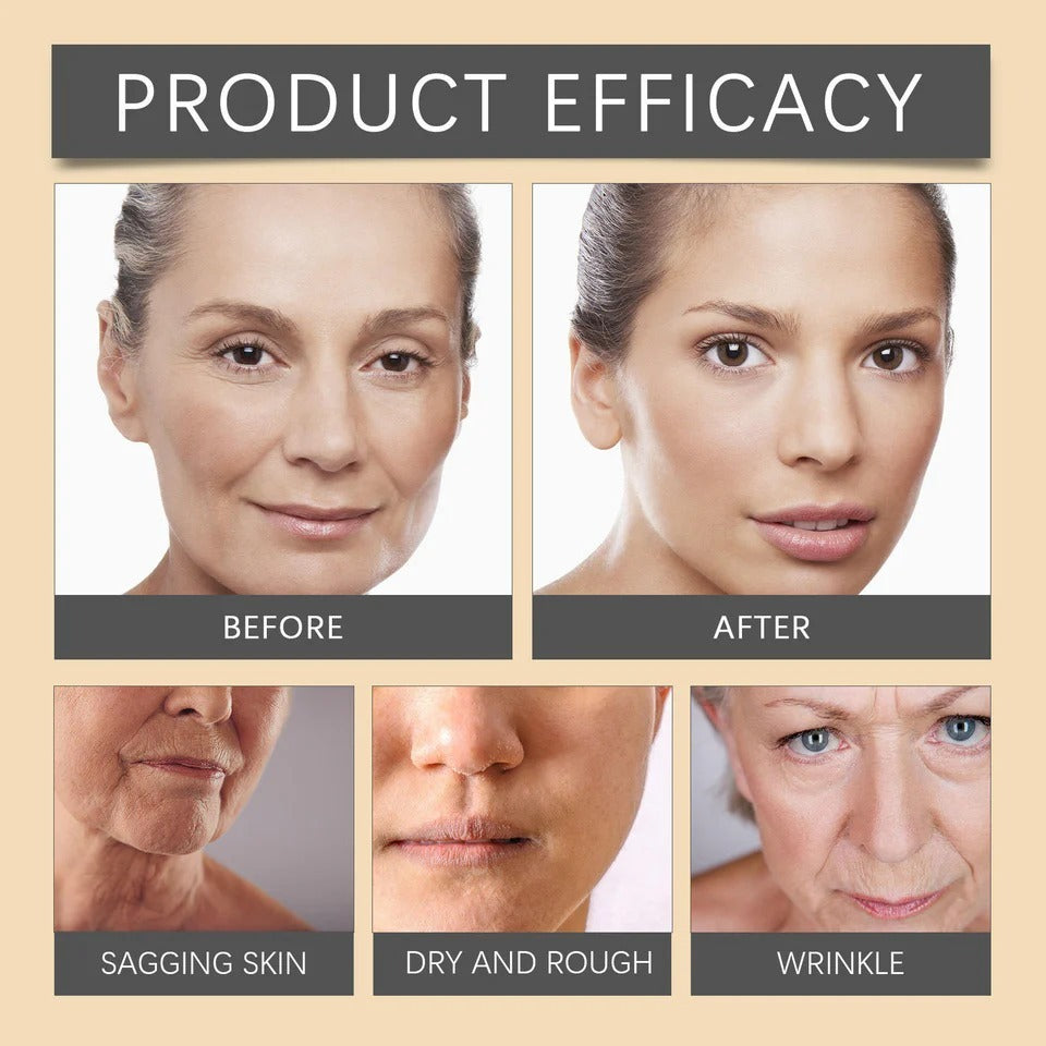 Botox Bee Venom Wrinkle Cream | Anti‑Aging Moisturizer